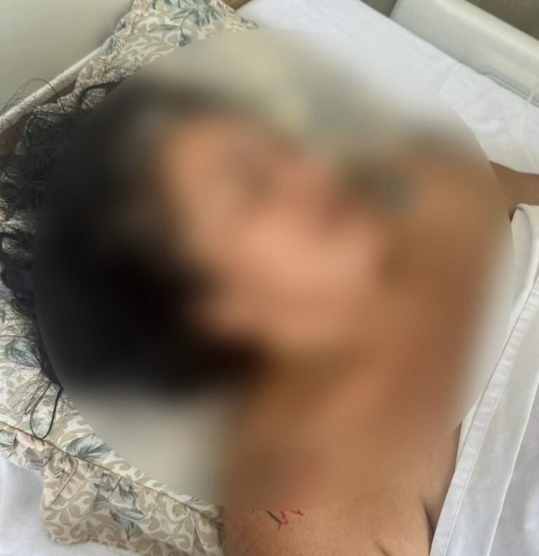 Familia denuncia retraso de biopsia en paciente internada en el Hospital O’Horán de Mérida