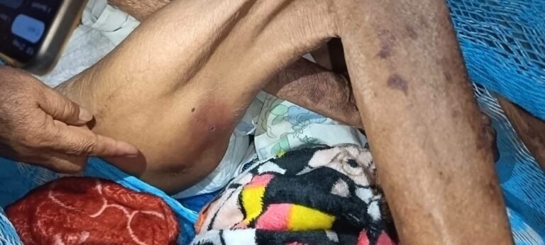 Adulta mayor de 88 años requiere ayuda urgente; piden intervención de autoridades y apoyo ciudadano en Mérida